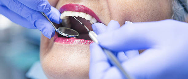 Best Walk-In Emergency Dentist in Winter Springs, FL